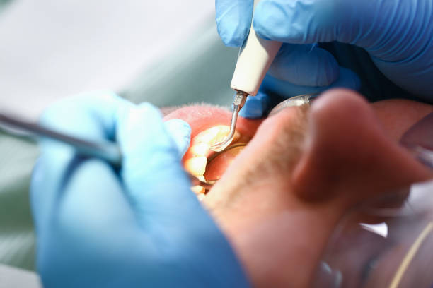 Best Cracked Tooth Emergency Dentist  in West Elmira, NY